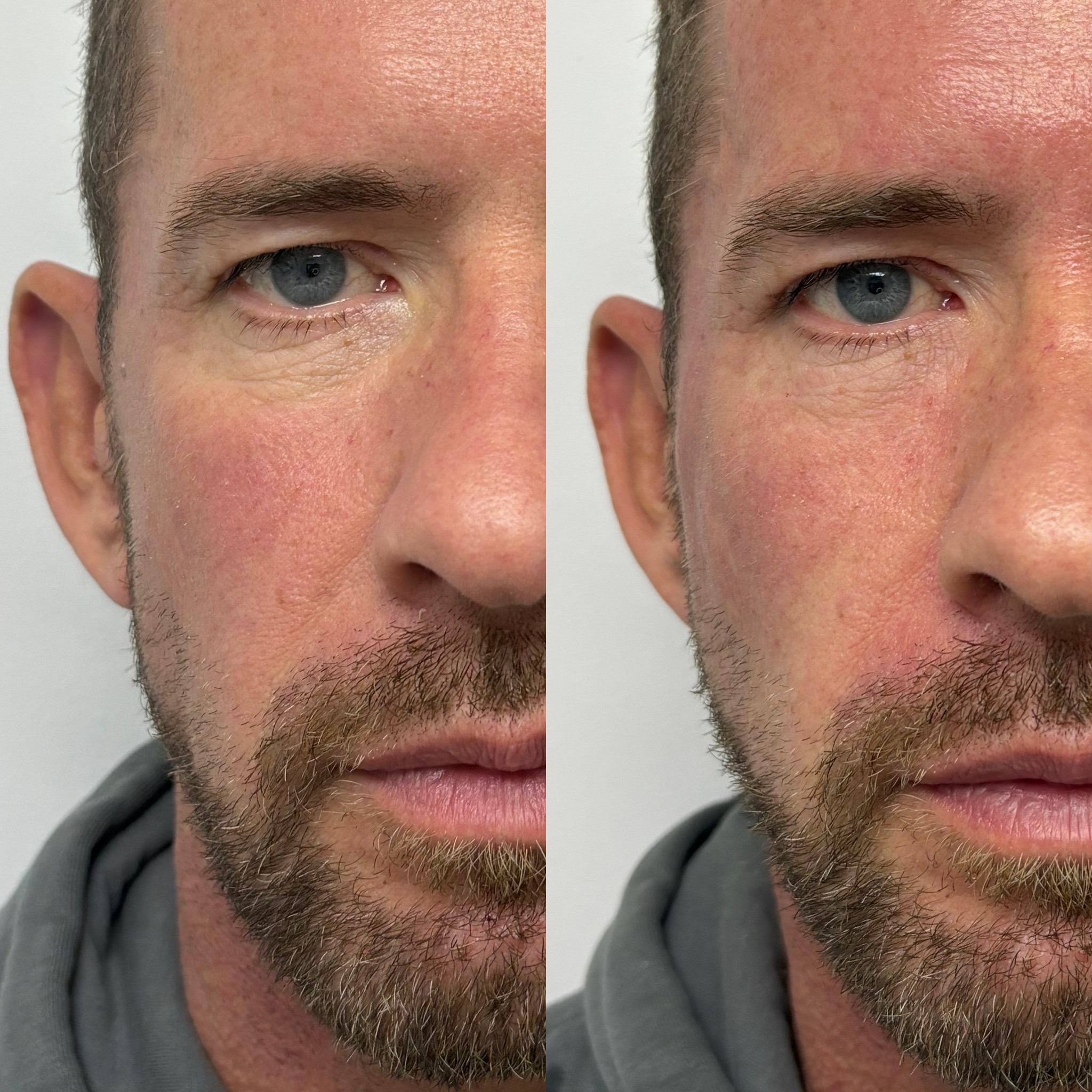 Before and after treatment result