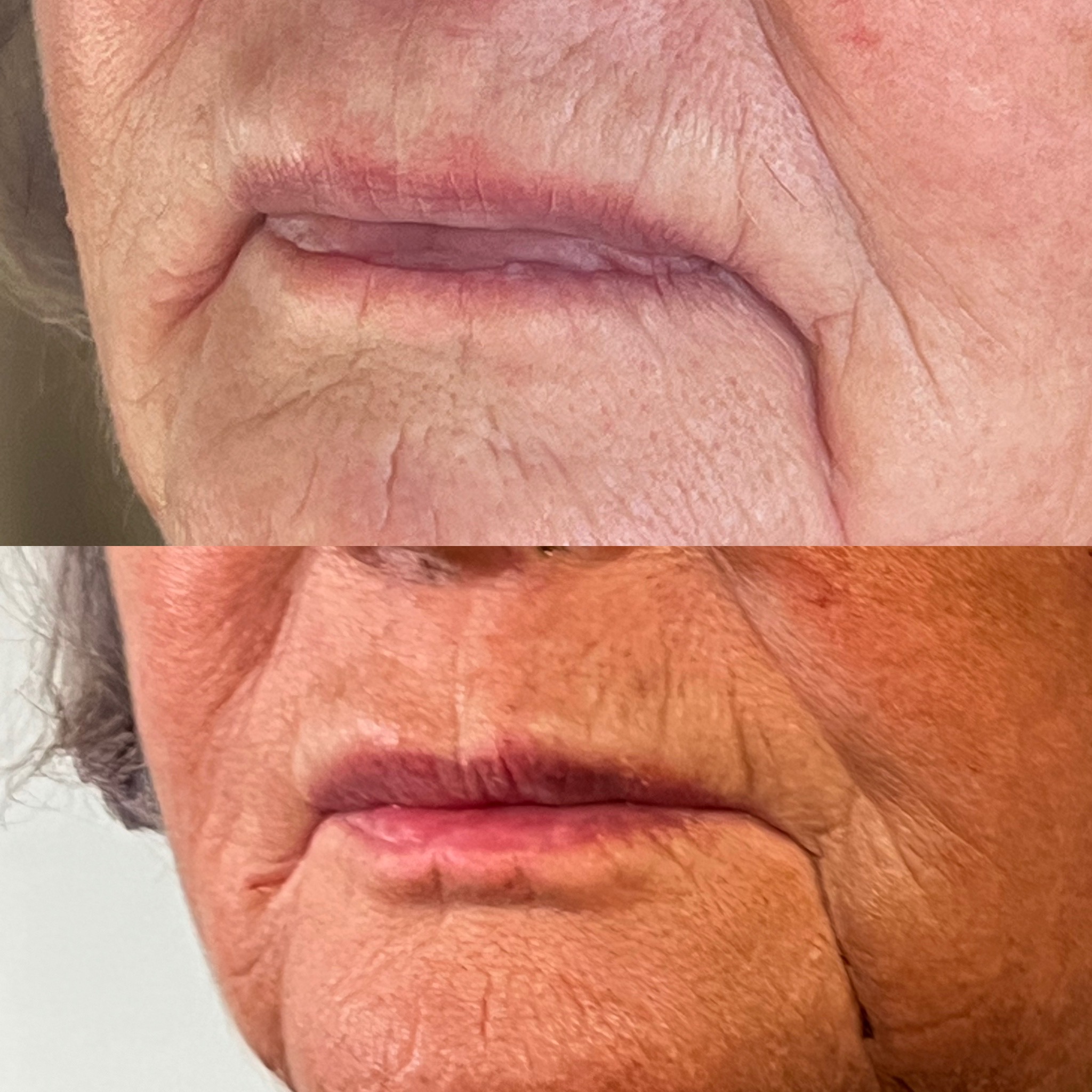 Before and after treatment result