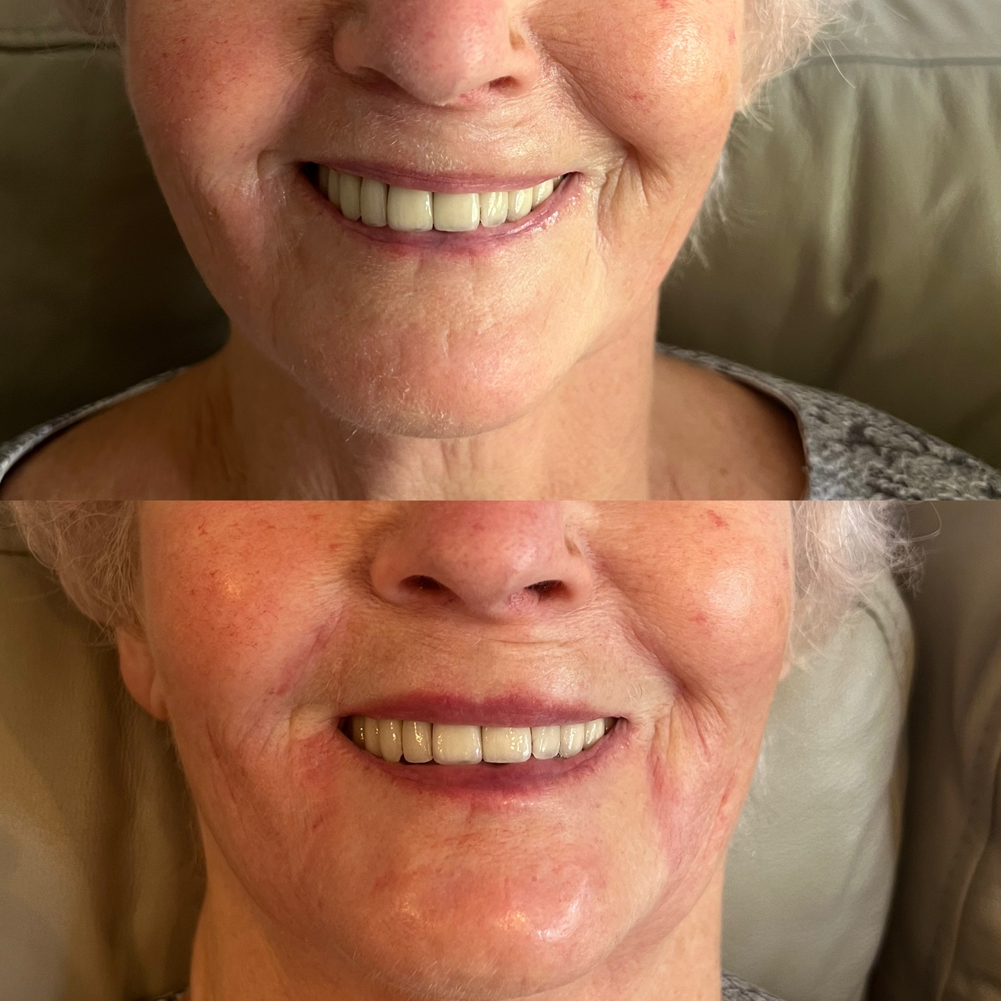 Before and after treatment result