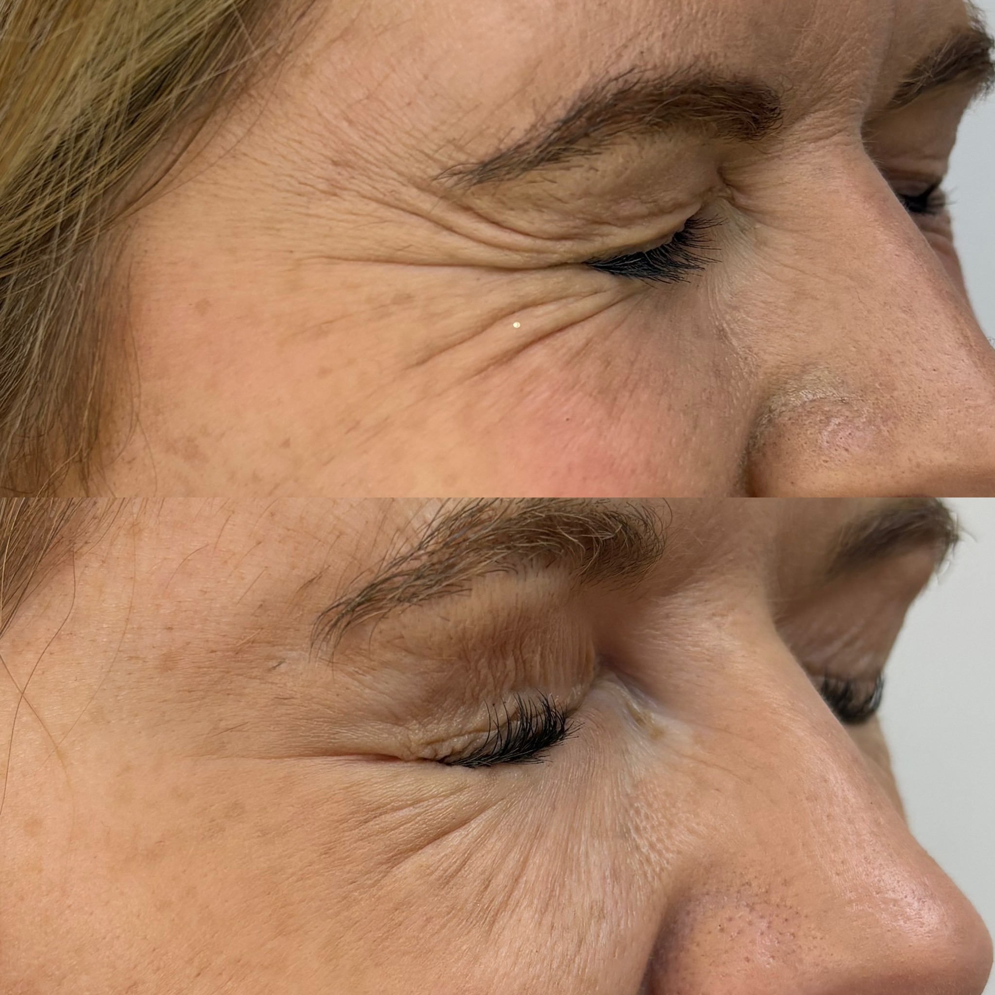 Before and after treatment result