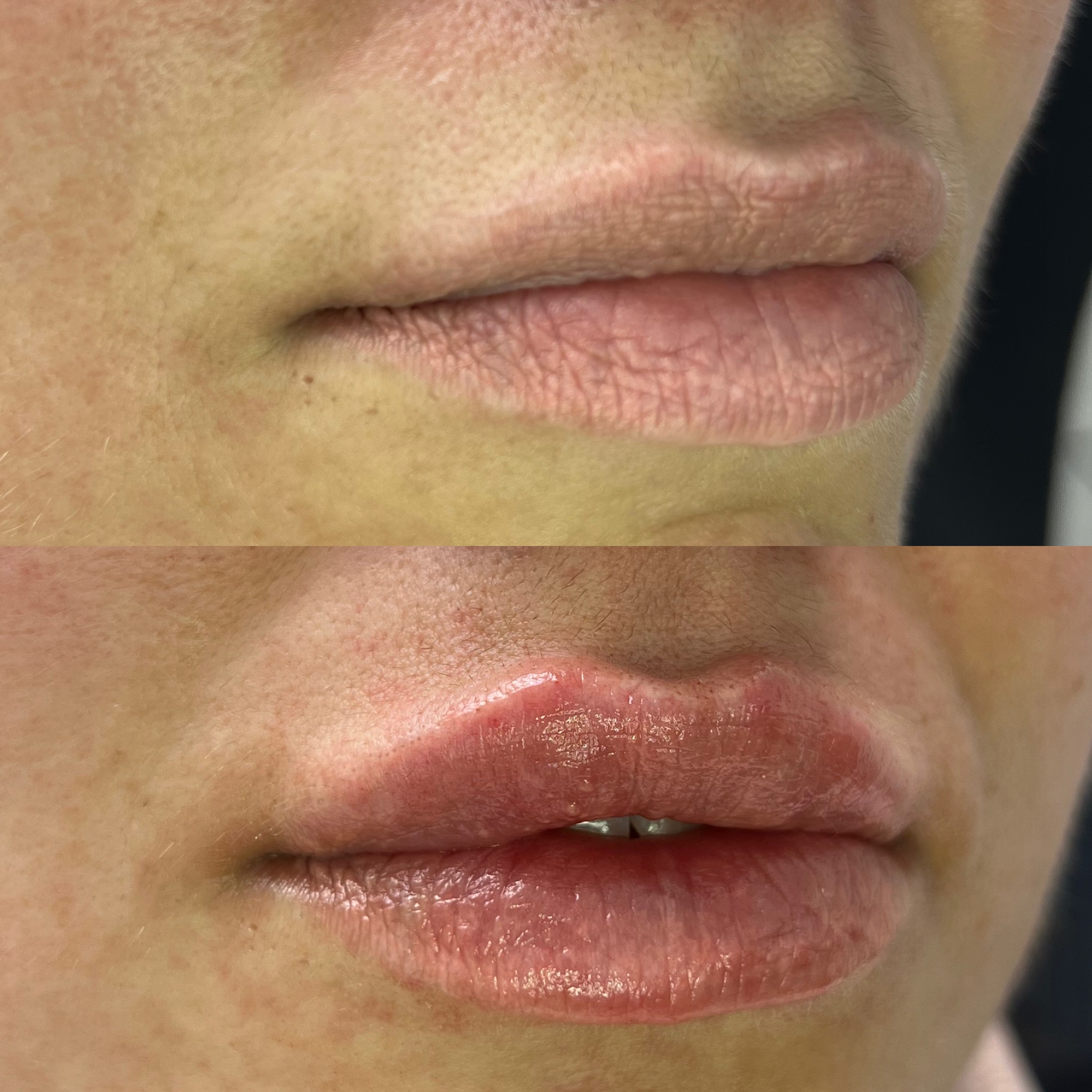 Before and after treatment result