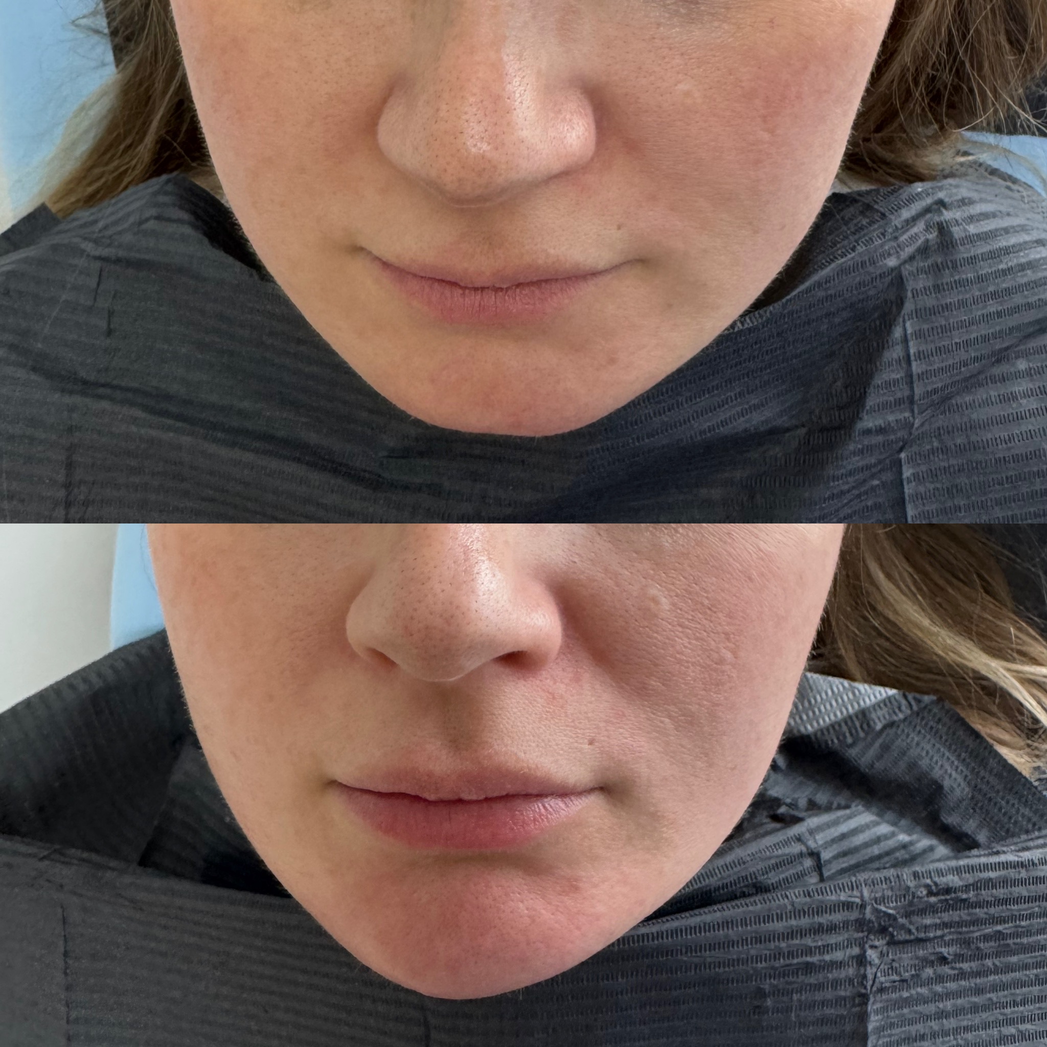 Before and after treatment result