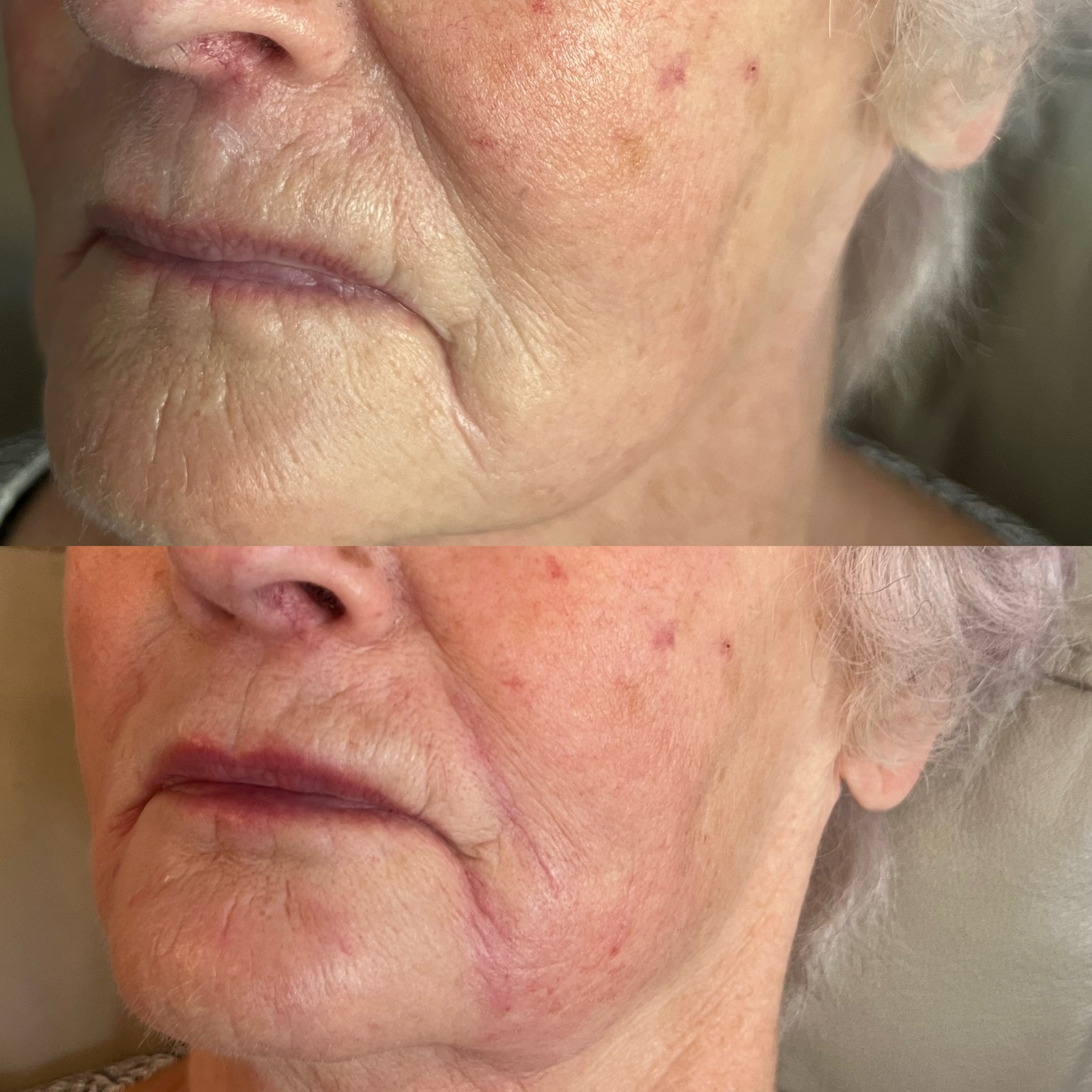 Before and after treatment result