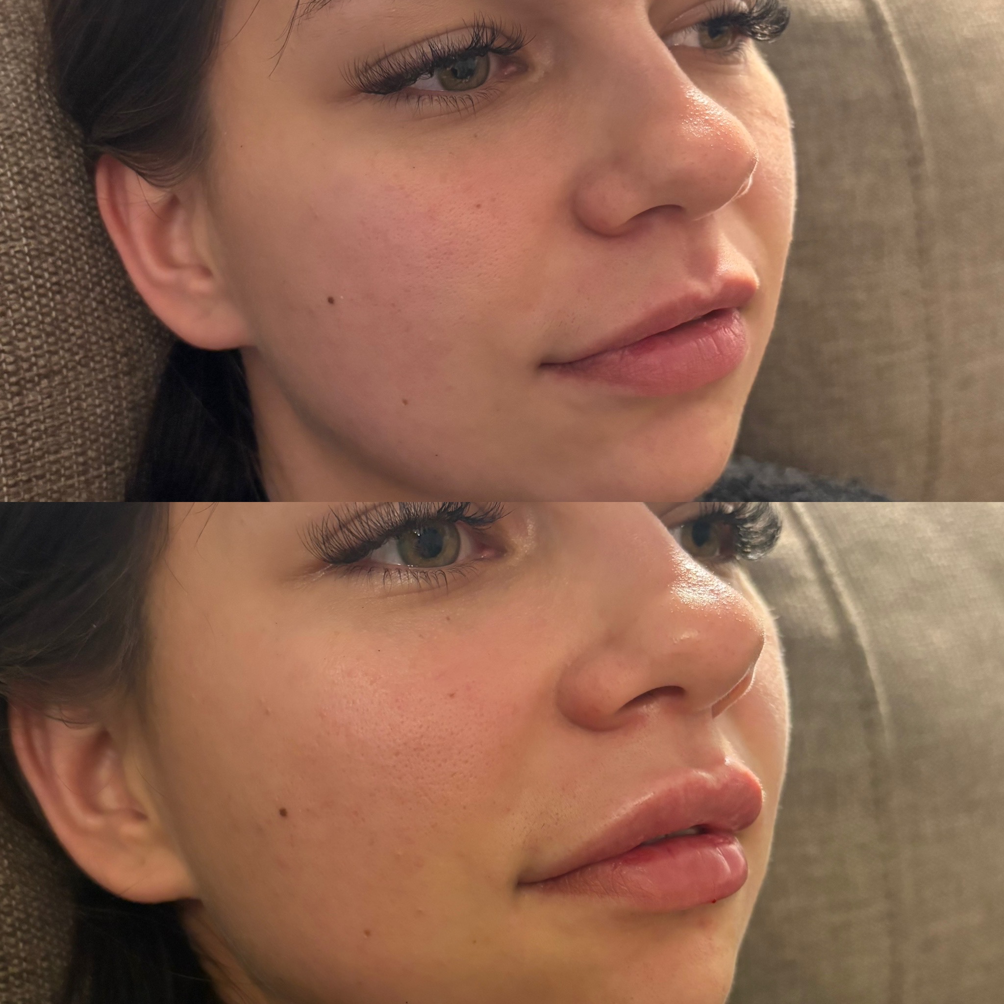 Before and after treatment result