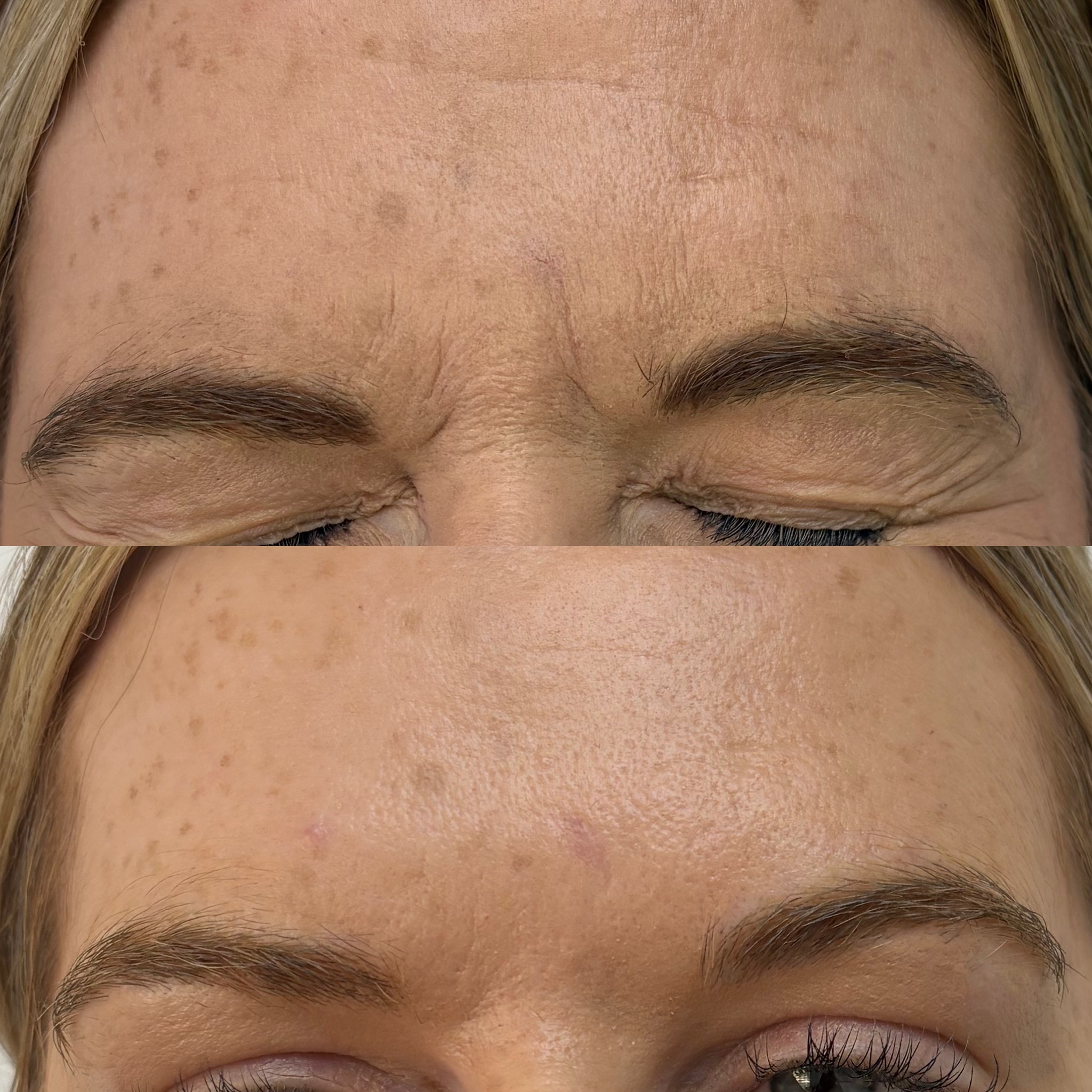 Before and after treatment result