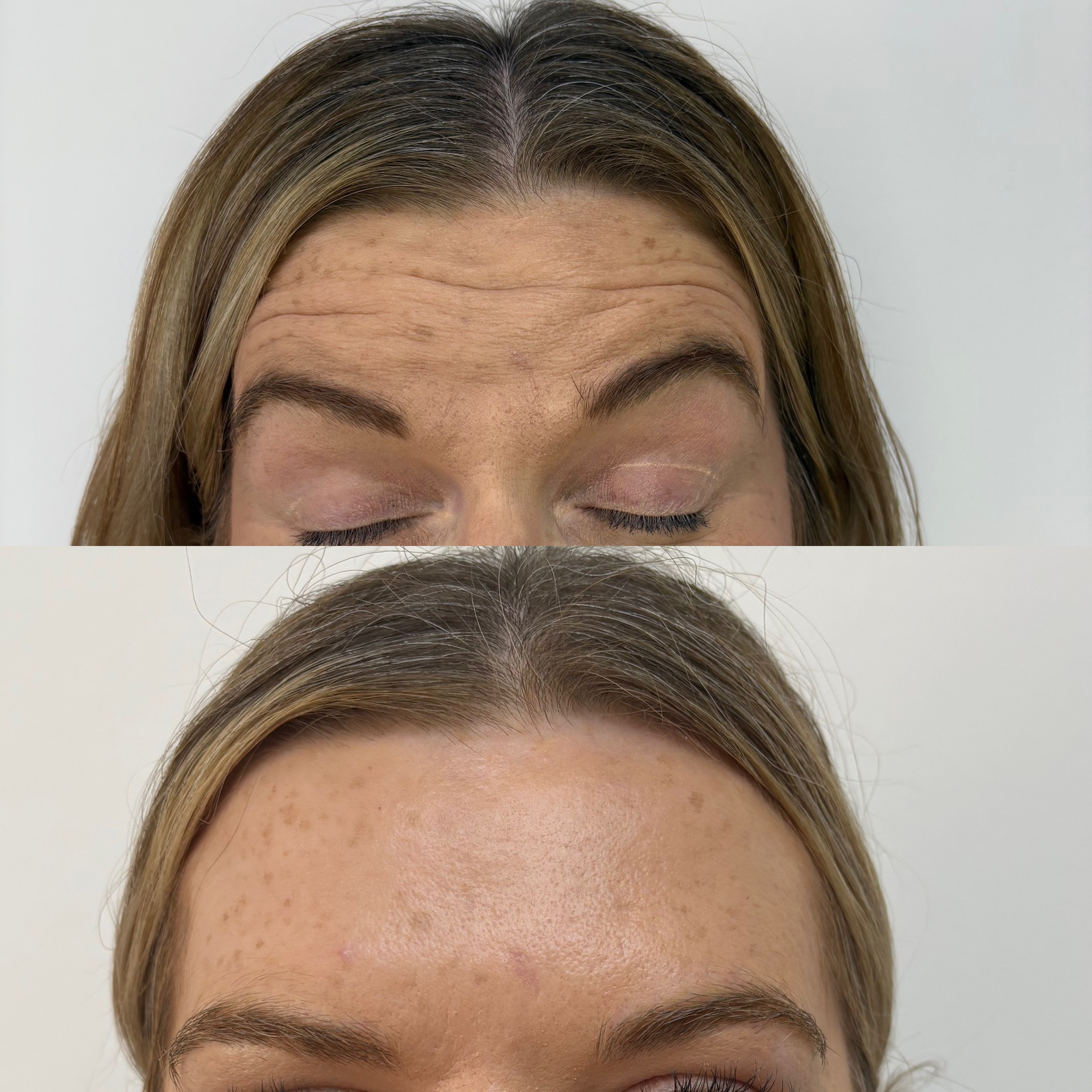 Before and after treatment result