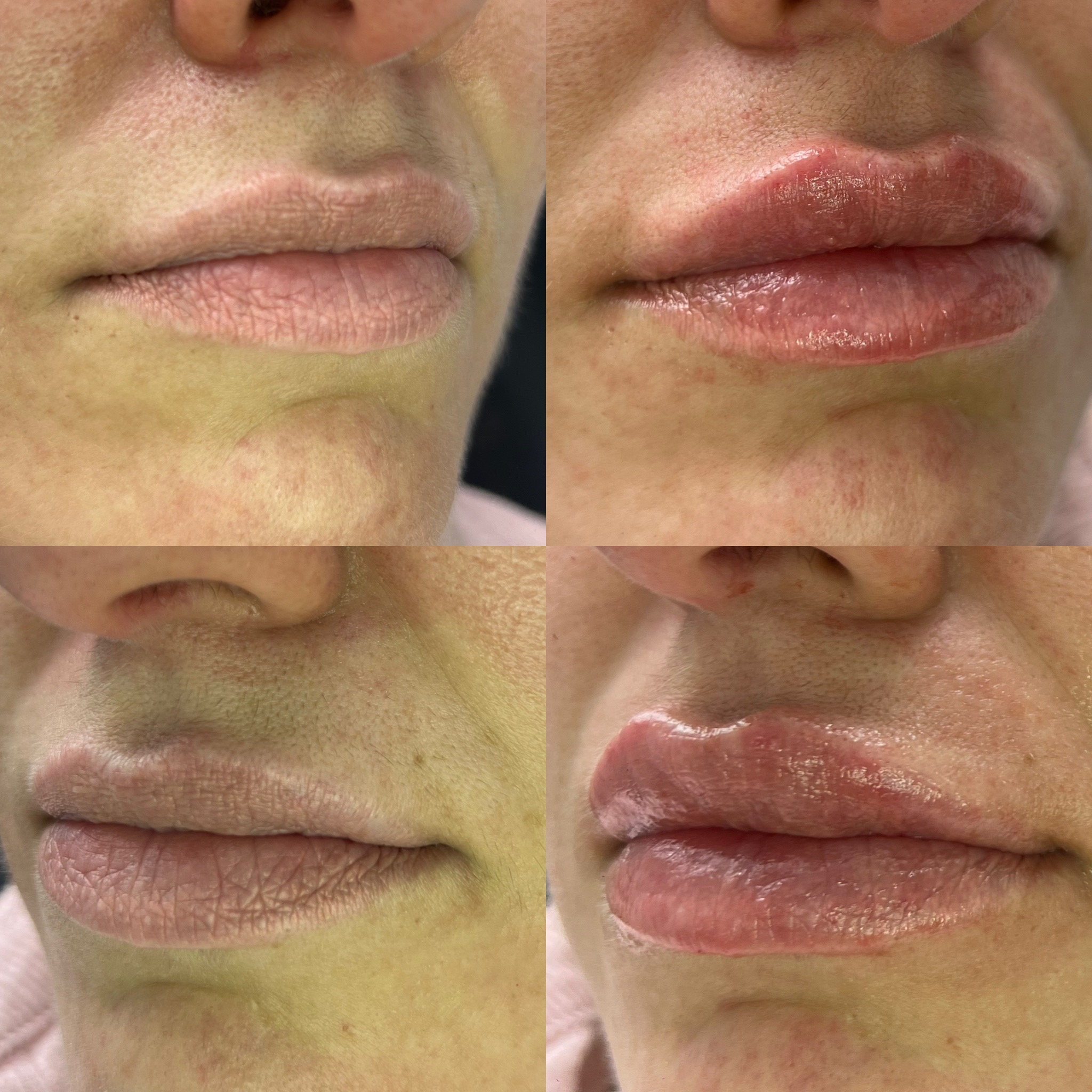 Before and after treatment result