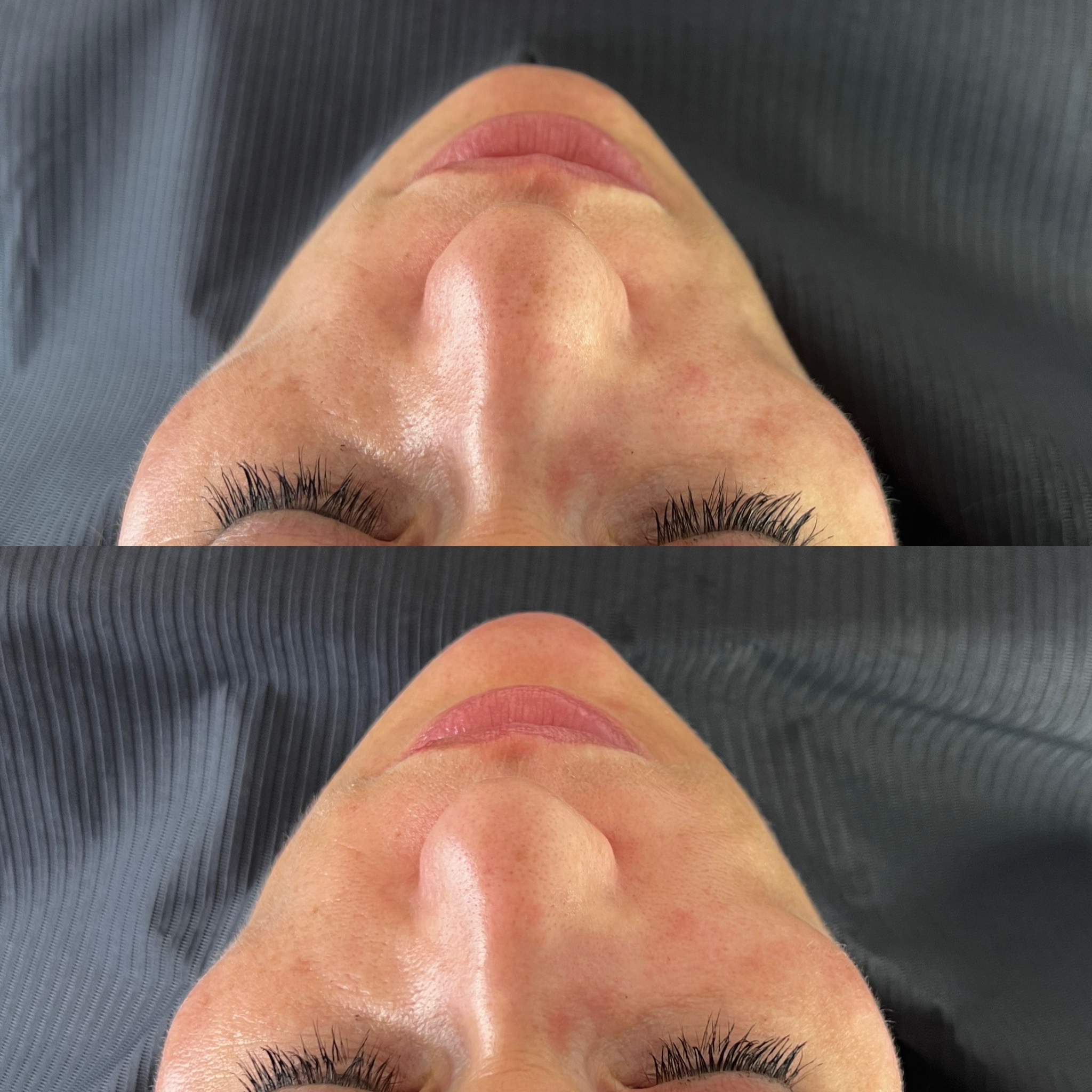 Before and after treatment result