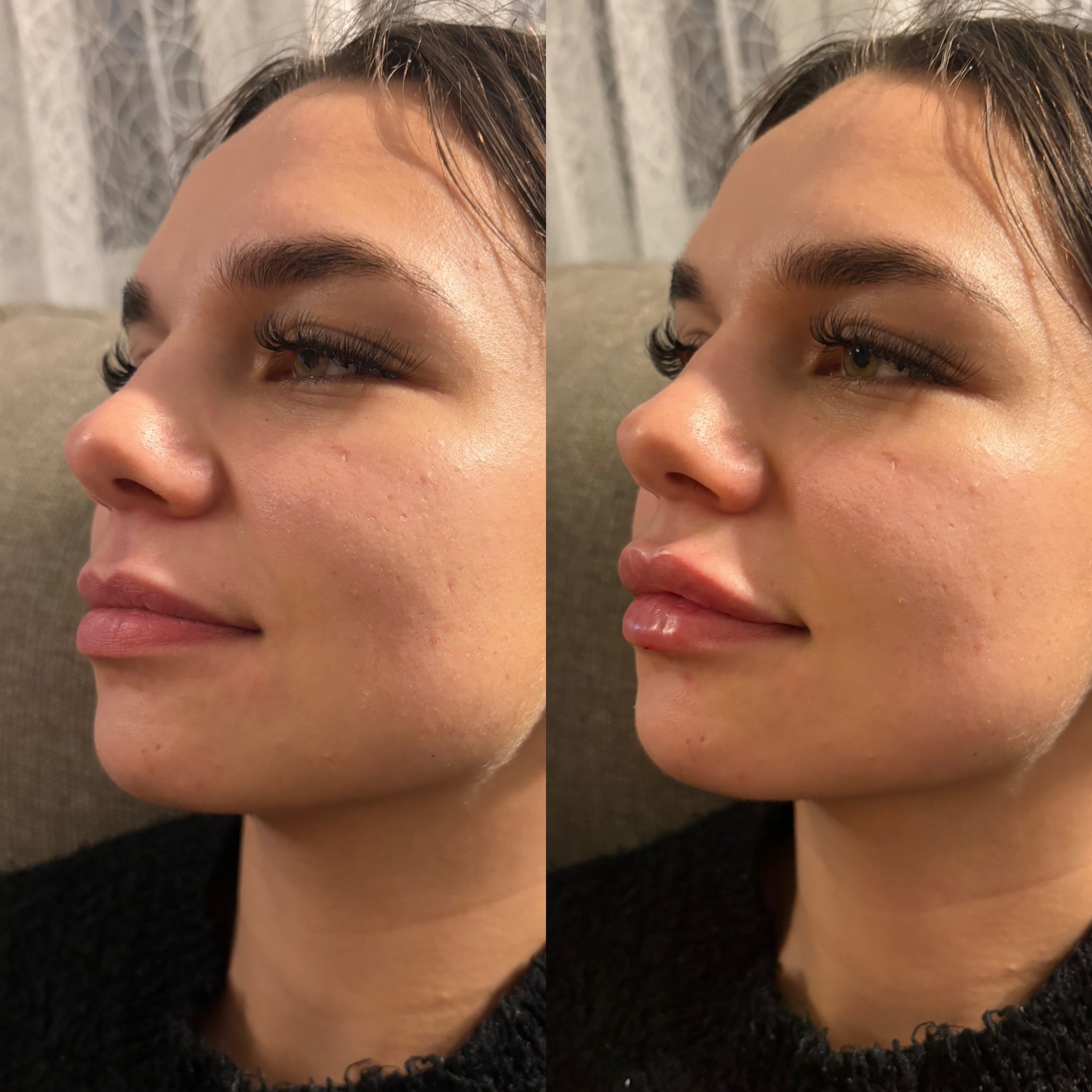 Before and after treatment result
