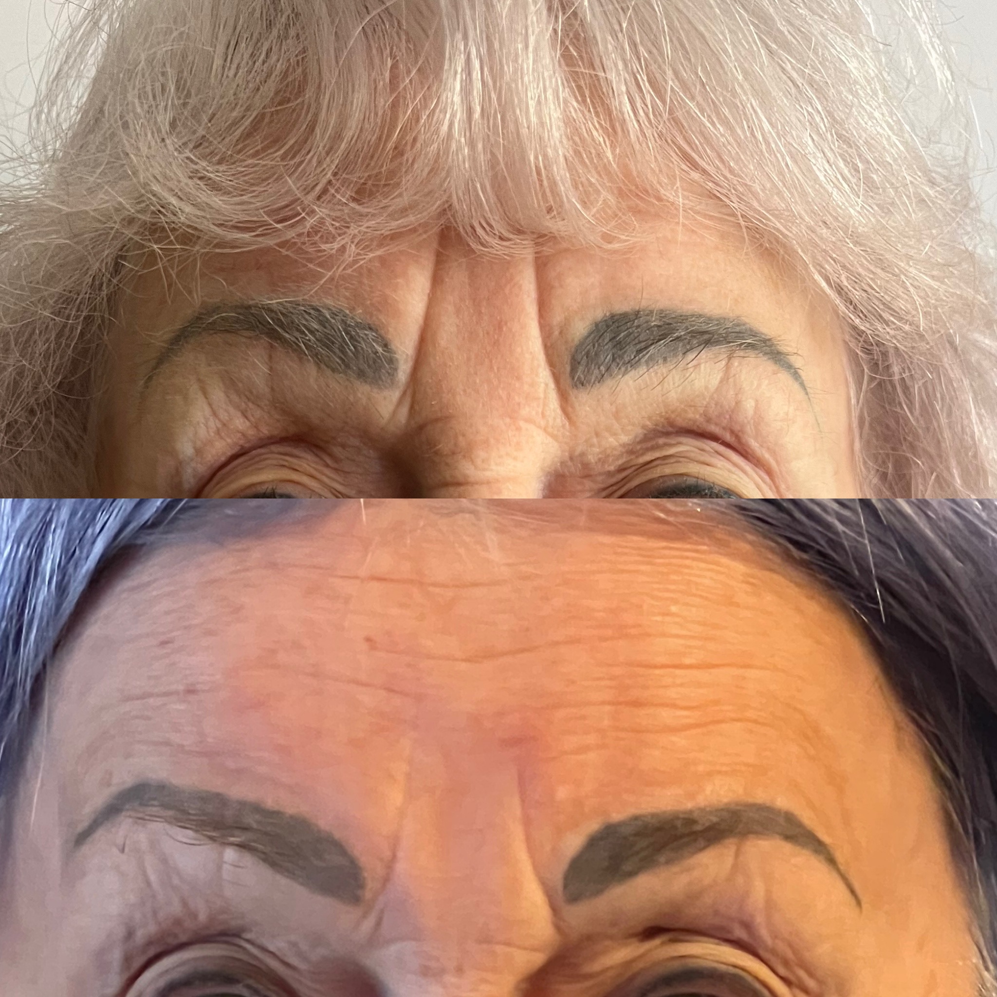 Before and after treatment result